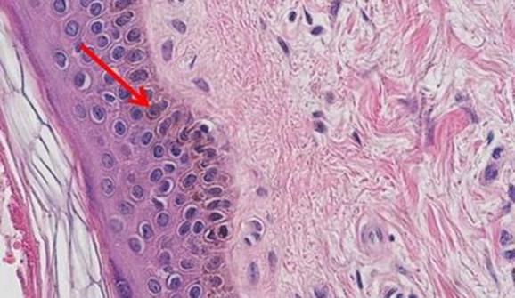 An Intro To H&E Staining: Protocol, Best Practices, Steps & More