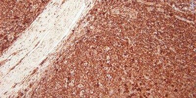 Intro To Immunohistochemistry (IHC) Staining: Steps & Best Practices