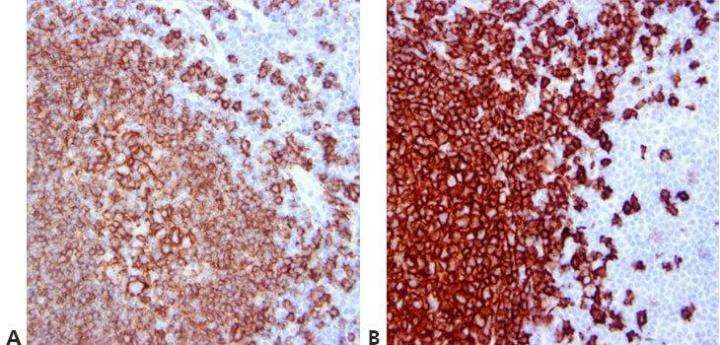 Intro To Immunohistochemistry (IHC) Staining: Steps & Best Practices