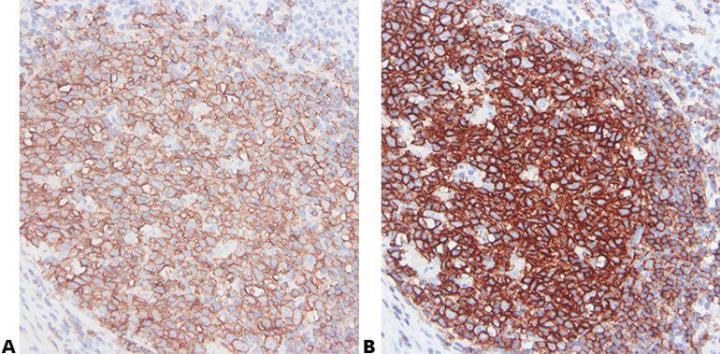 Intro To Immunohistochemistry (IHC) Staining: Steps & Best Practices