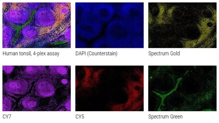 Modern Multiplex Solutions for the Research Lab | Leica Biosystems