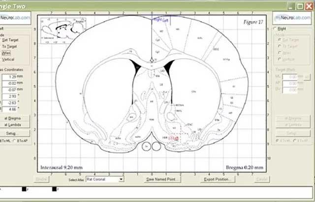 approach-angle-in-stereotaxic-surgery-640x410 approach-angle-in-stereotaxic-surgery-640x410