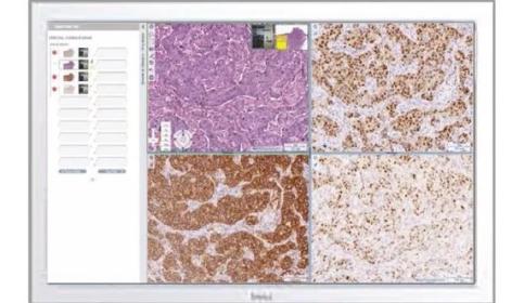 Aperio Digital Pathology Management Software